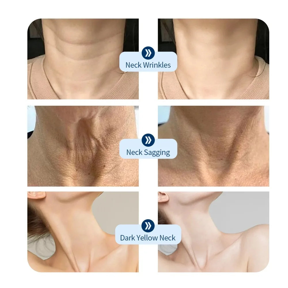 LED Skin Therapy Mask – 7 Colors for Acne, Wrinkles & Glow