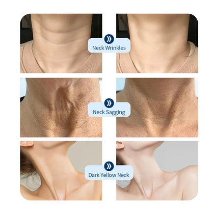 LED Skin Therapy Mask – 7 Colors for Acne, Wrinkles & Glow